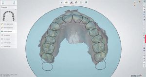 Dental System 2021.2